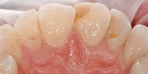 Before - 5 Dental