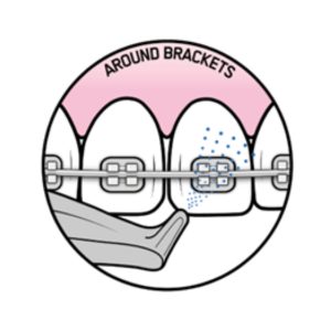 around brackets