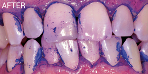 After - 5 Dental