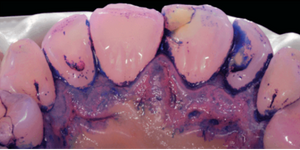 After - 5 Dental - 2