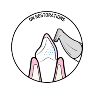 on restorations