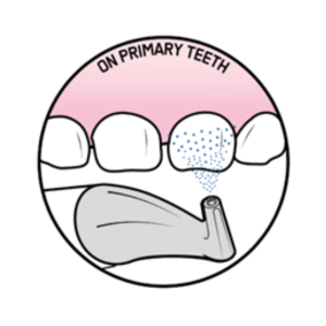 on primary teeth