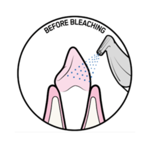 Before Bleaching