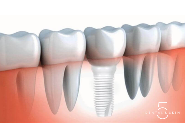 Zirconia